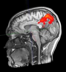 fMRT-Aufnahme des Gehirns eines 24-jährigen Probanden.